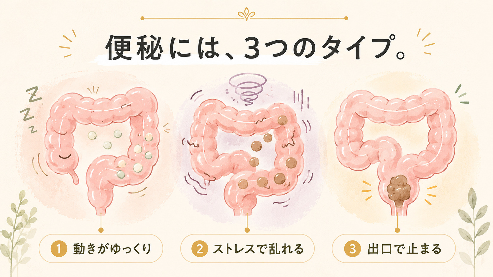 便秘の3タイプを並べた図解イラスト